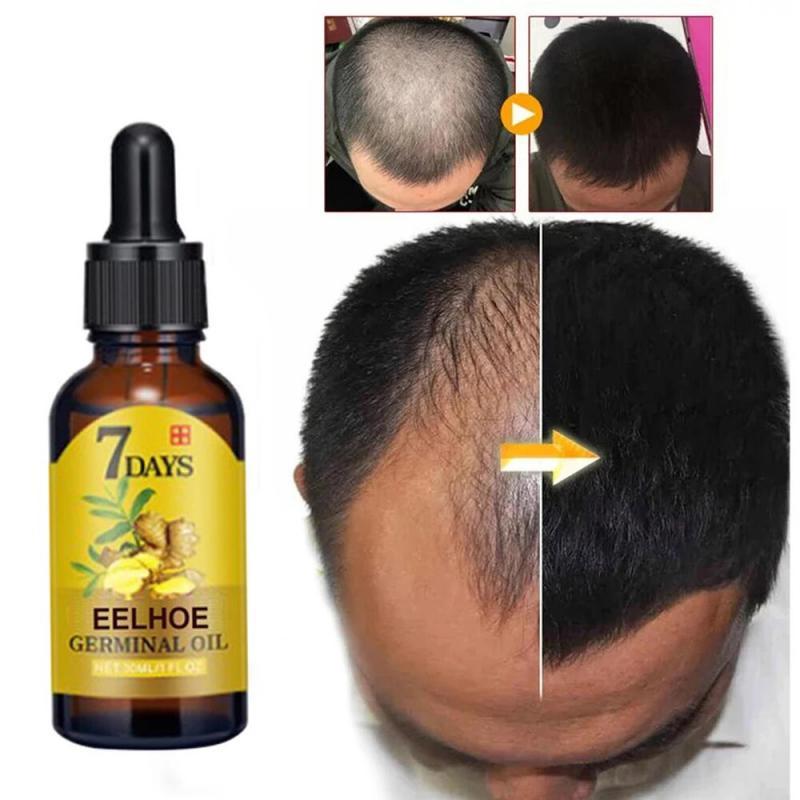 Hair Growth Serum Fast Growing Hair Essential Oil Beauty Hair Care 10/20/40ml Dense Regrowth Ginger Hair Promoting Regeneration