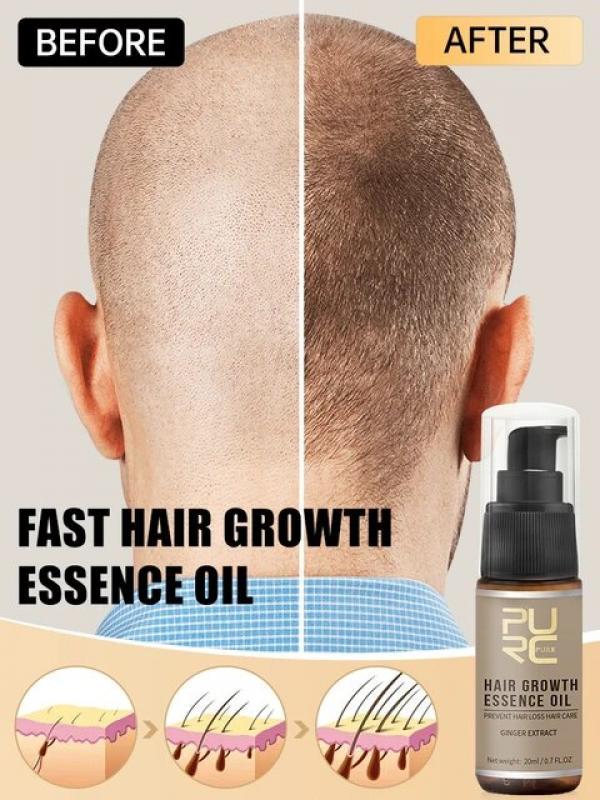 PURC Hair Growth Oil for Men Women Anti Hair Loss Scalp Treatment Serum Ginger 7 Day Fast Regrowth Care Hair Growth Products