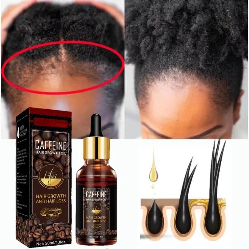 Alopecia Hair Treatment for Women Hairloss Hair Oil Growth Tool Spray Caffeine for Treatment Dry Frizzy Damaged Thin Hair Care